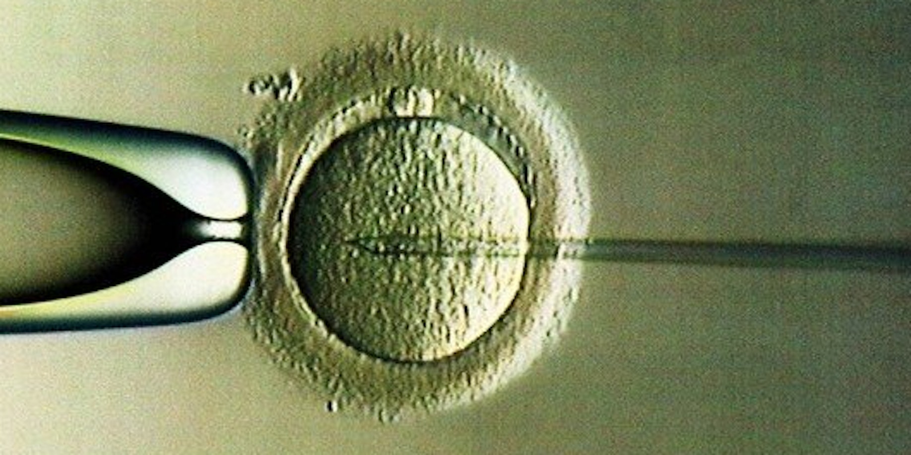 In vitro-Fertilisation ist in Polen heiß umstritten.